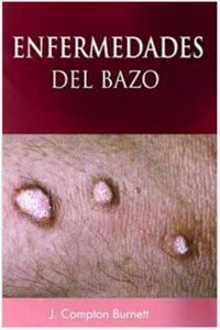 Enfermedades Del Bazo