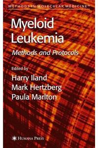Myeloid Leukemia: Methods and Protocols. Methods in Molecular Medicine.