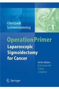 Laparoscopic Sigmoidectomy for Cancer