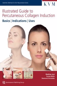 Illustrated Guide to Percutaneous Collagen Induction: Basics / Indications / Uses