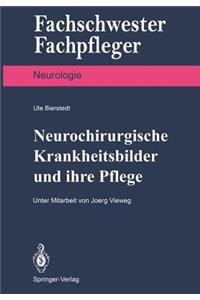 Neurochirurgische Krankheitsbilder Und Ihre Pflege