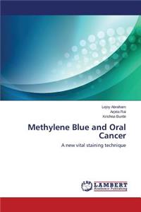 Methylene Blue and Oral Cancer