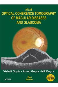 Atlas Optical Coherence Tomography of Macular Dis.