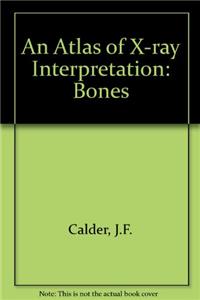 An Atlas of X-ray Interpretation: Bones