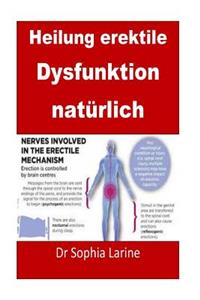 Cure erektile Dysfunktion natürlich