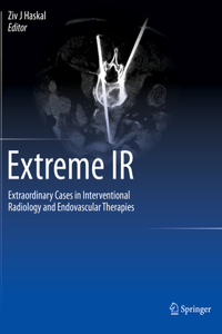 Extreme IR