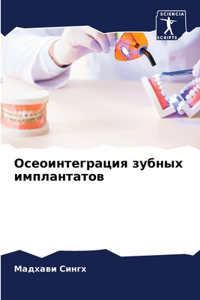 Осеоинтеграция зубных имплантатов