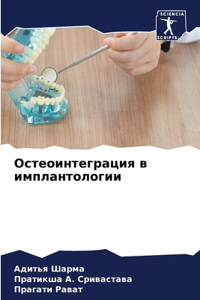 Остеоинтеграция в имплантологии