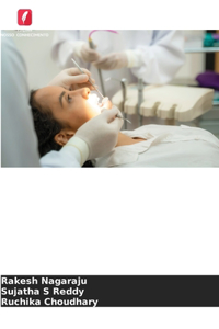 Síndrome de Sjogren