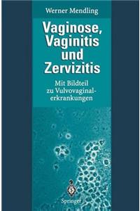 Vaginose, Vaginitis Und Zervizitis: Mit Bildteil Zu Vulvovaginalerkrankungen