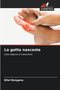 gotta nascosta