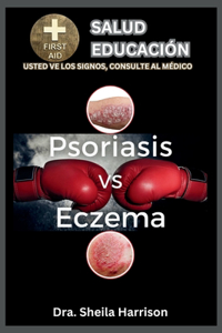 Psoriasis vs. Eczema