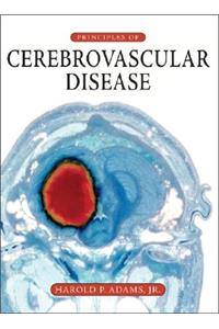 Principles of Cerebrovascular Disease
