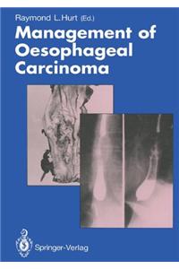 Management of Oesophageal Carcinoma