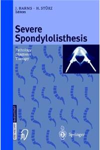Severe Spondylolisthesis