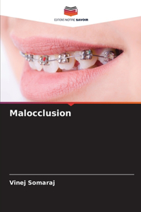 Malocclusion