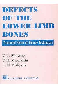 Defects Of The Lower Limb Bones