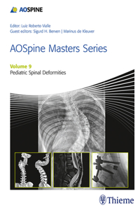 Aospine Masters Series, Volume 9: Pediatric Spinal Deformities