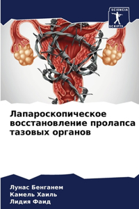 Лапароскопическое восстановление прола&#