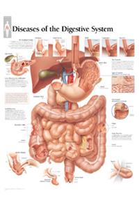 Diseases of the Digestive System Laminated Poster