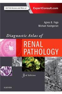 Diagnostic Atlas of Renal Pathology