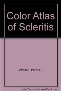 Color Atlas of Scleritis