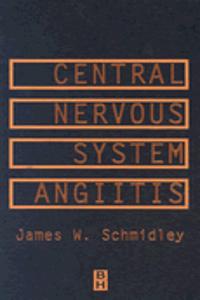 Central Nervous System Angiitis, 1e