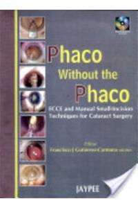 Phaco without Phaco with 2 CD-ROMs