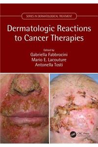 Dermatologic Reactions to Cancer Therapies