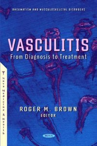 Vasculitis