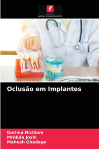 Oclusão em Implantes
