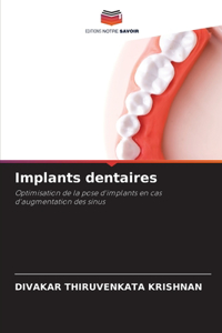 Implants dentaires