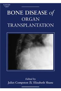 The Bone Disease of Organ Transplantation