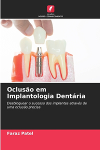 Oclusão em Implantologia Dentária