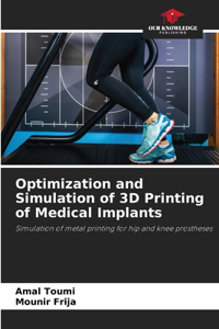 Optimization and Simulation of 3D Printing of Medical Implants