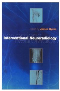 Interventional Neuroradiology