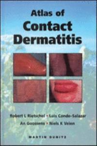Atlas of Contact Dermatitis