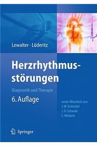 Herzrhythmusstörungen