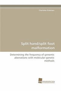 Split Hand/Split Foot Malformation