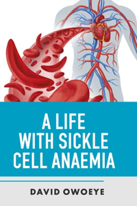 Life with Sickle Cell Anaemia