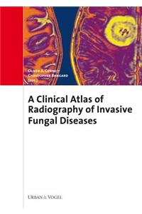 Atlas of Radiography and Clinics of Invasive Fungal Infections