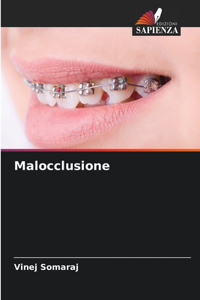 Malocclusione