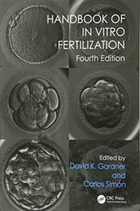 HANDBOOK OF IN VITRO FERTILIZATION