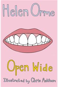 Open Wide