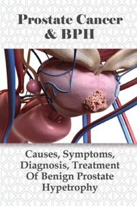 Prostate Cancer & BPH