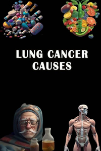 Lung Cancer Causes