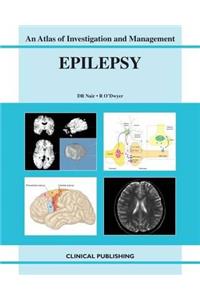 Epilepsy