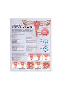 Understanding Cervical Cancer Anatomical Chart