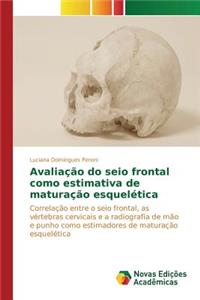 Avaliação do seio frontal como estimativa de maturação esquelética