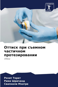 Оттиск при съемном частичном протезирова